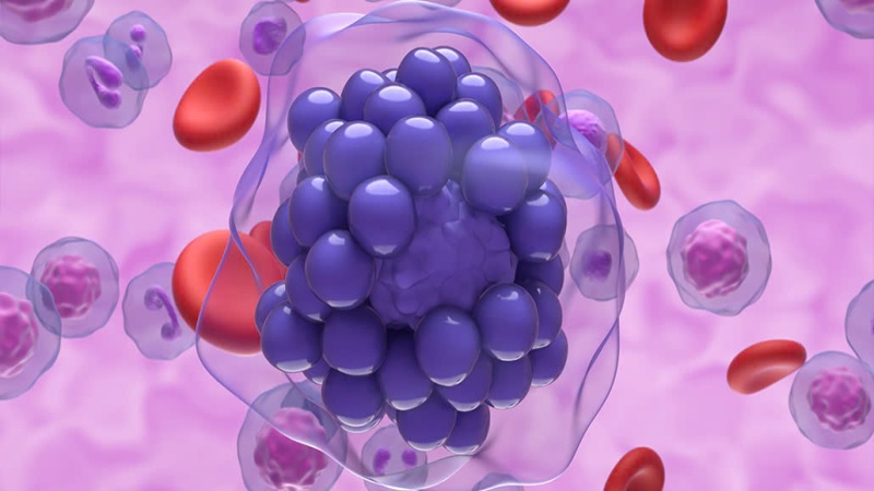 Ung thư huyết học liên quan đến sự tăng sinh bất thường của tế bào B (Ảnh: Sưu tầm Internet)