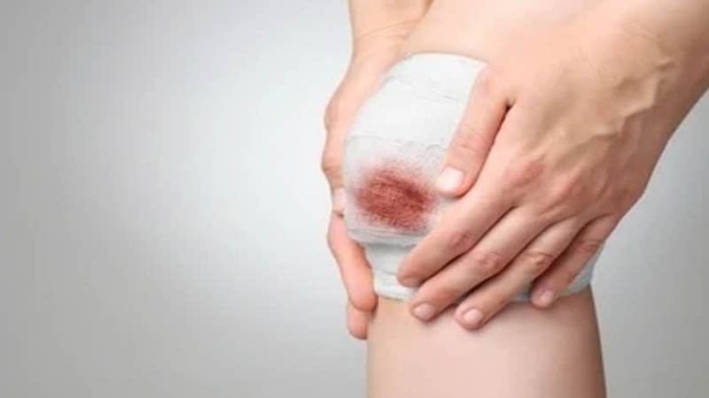 Sai lầm trong chăm sóc làm vết thương lâu lành hơn (Ảnh: Sưu tầm Internet)