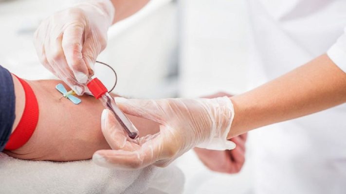 Xét nghiệm albumin để làm gì? Cảnh báo nguy cơ bệnh lý tiềm ẩn