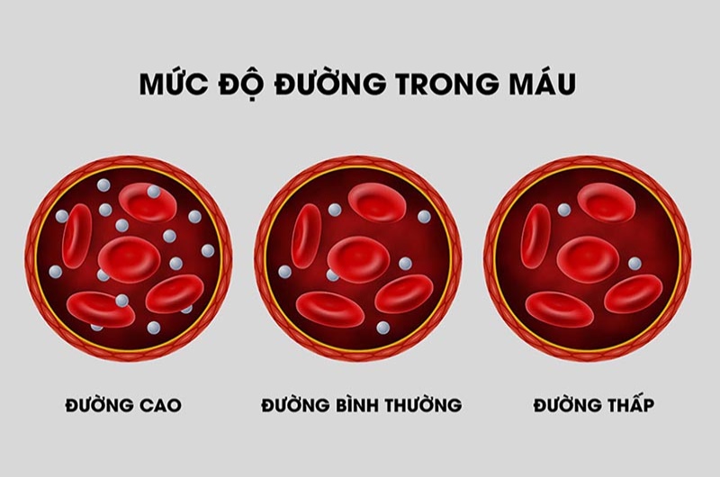 Đường huyết cao sẽ bị gì là thắc mắc của nhiều người quan tâm đến sức khỏe hiện nay (Nguồn: Internet)