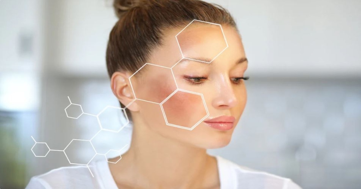 Tăng sắc tố melanin là gì? Thủ phạm khiến da ngày càng sạm màu