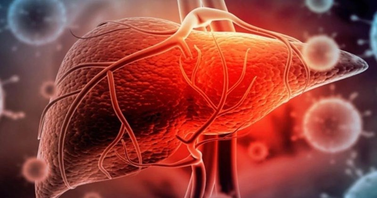 Thải độc gan đúng cách: Nguyên tắc vàng để tránh quá tải gan