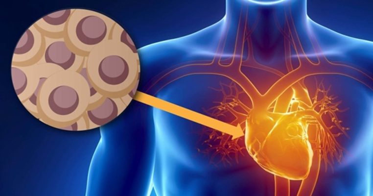 Trẻ hóa tế bào tim mạch – Ngăn lão hóa sớm, bảo vệ tim bền vững
