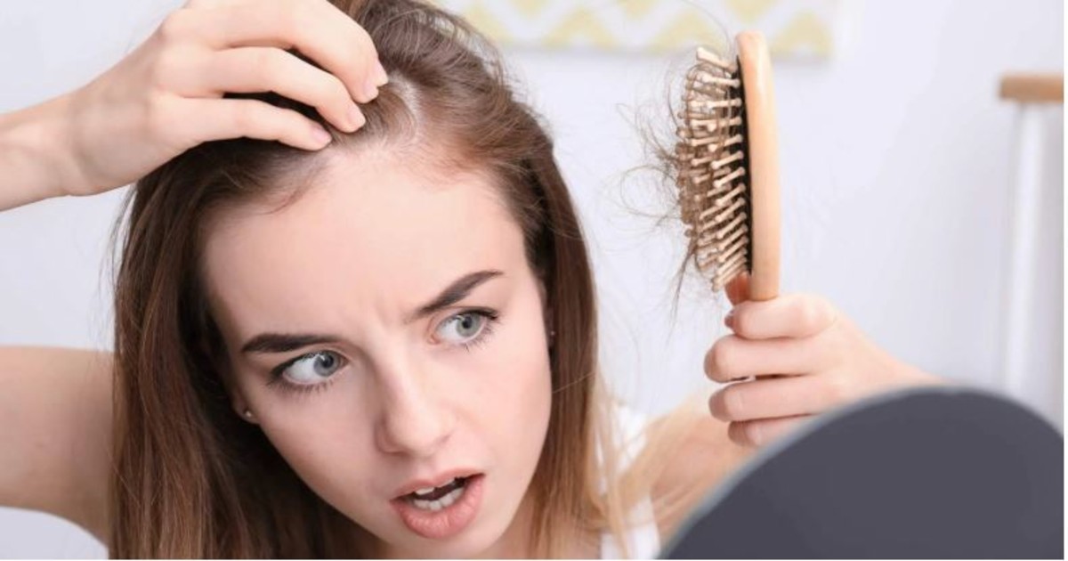 Rụng tóc nội tiết: Nguyên nhân và cách điều trị dứt điểm từ gốc