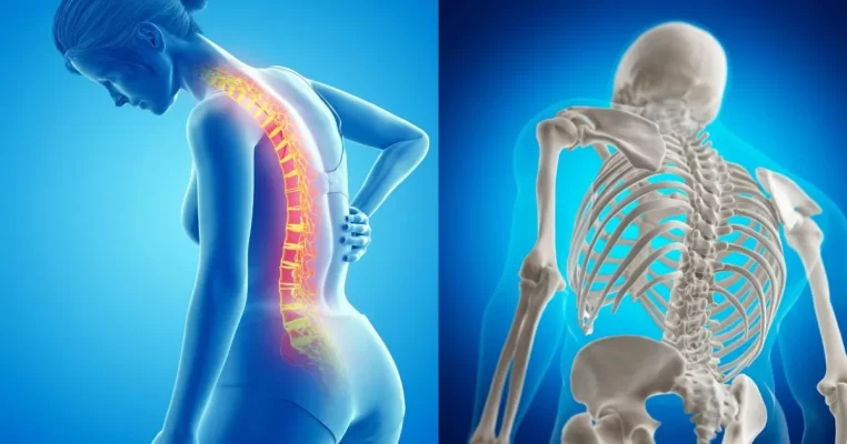 Yếu tố gây loãng xương ở nữ giới thường bị bỏ qua: Nội tiết tố