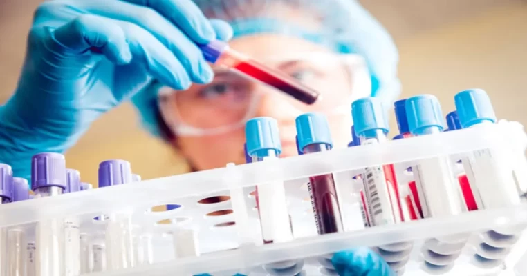 Xét nghiệm Estrogen: Bí quyết giữ gìn nét xuân và sức khỏe