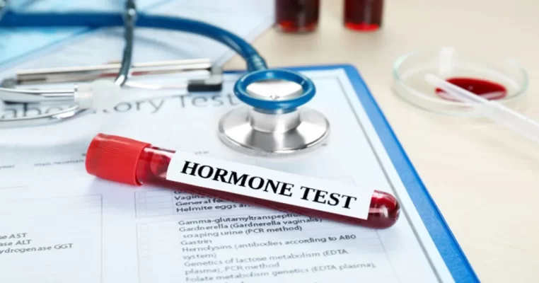 Xét nghiệm nội tiết tố nữ gồm những gì? Giải đáp chi tiết từ bác sĩ