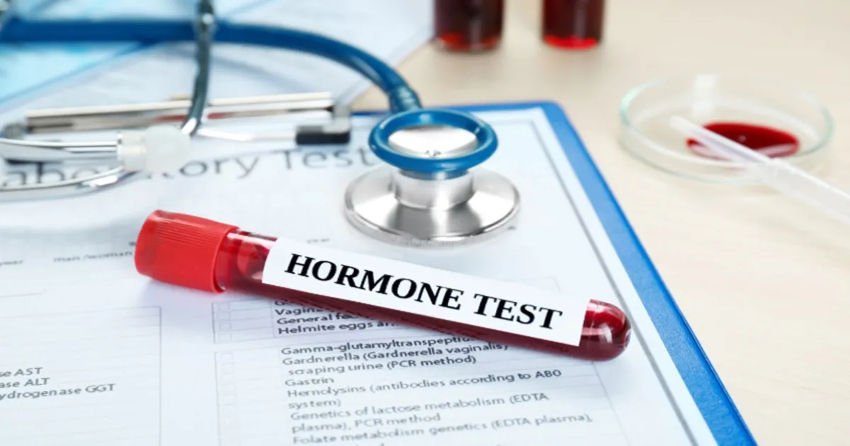 Xét nghiệm nội tiết tố nữ gồm những gì? Giải đáp chi tiết từ bác sĩ