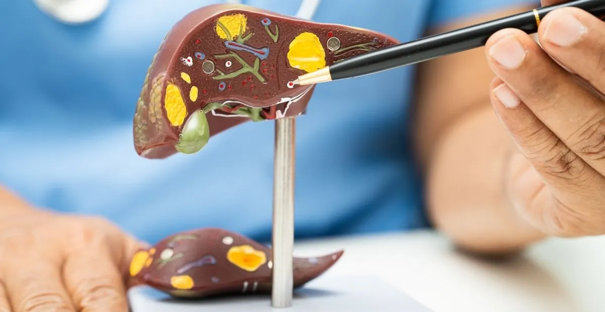 Gan nhiễm mỡ là gì