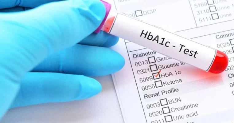 Xét nghiệm Hba1c là xét nghiệm gì? Phát hiện sớm tiểu đường