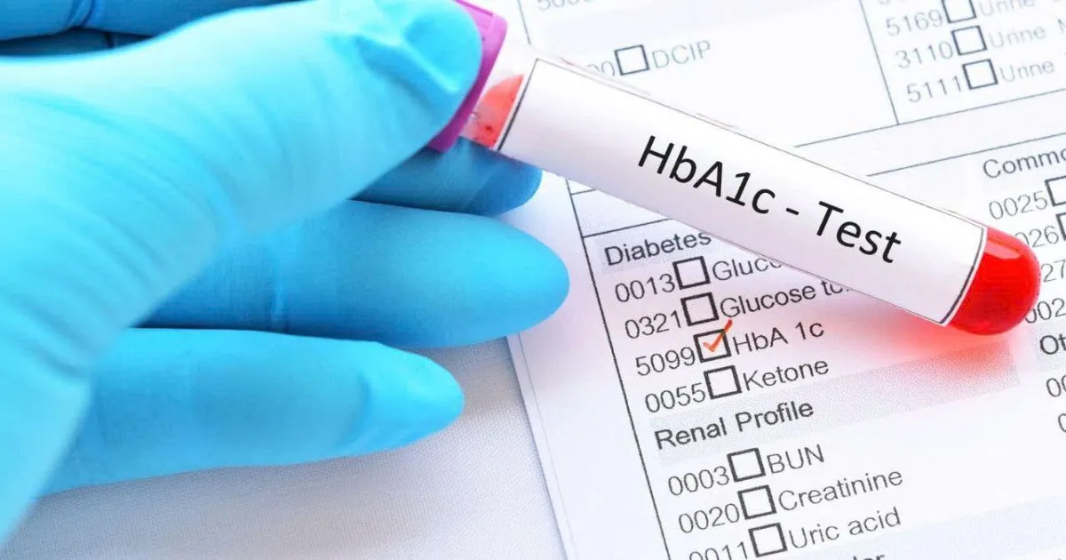Xét nghiệm Hba1c là xét nghiệm gì? Phát hiện sớm tiểu đường