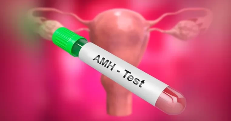 Xét nghiệm AMH