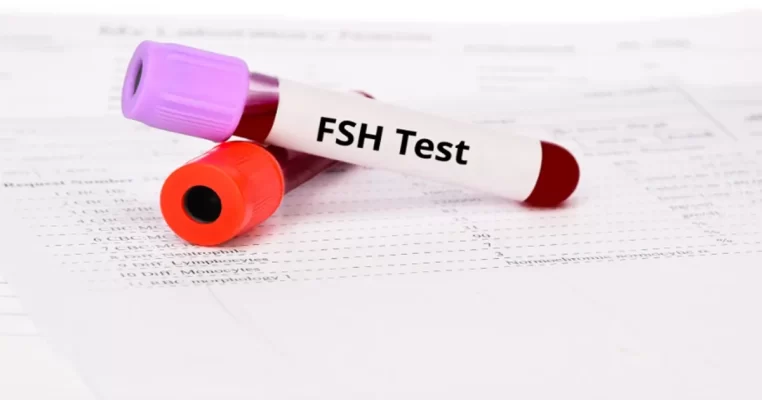 Xét nghiệm FSH