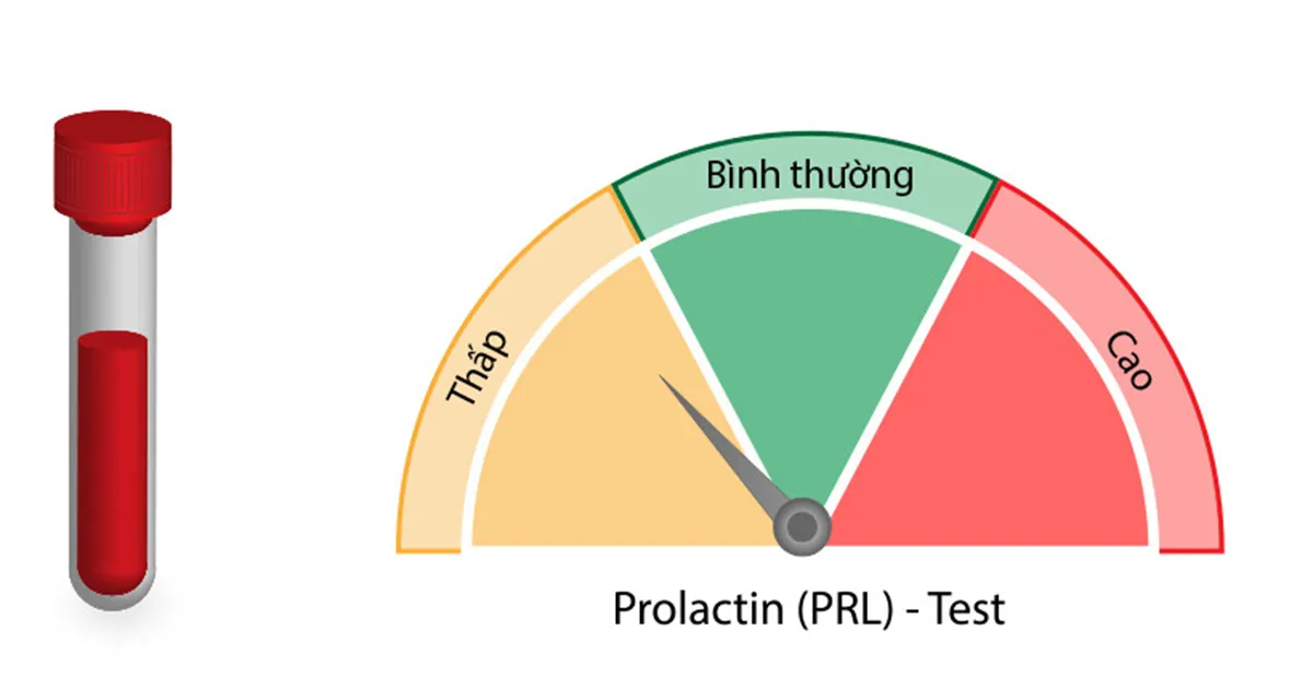 Xét nghiệm prolactin quan trọng thế nào cho sức khỏe?
