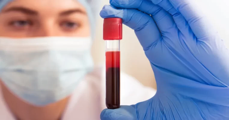 Xét nghiệm testosterone: Kết quả nói gì về sức khỏe?