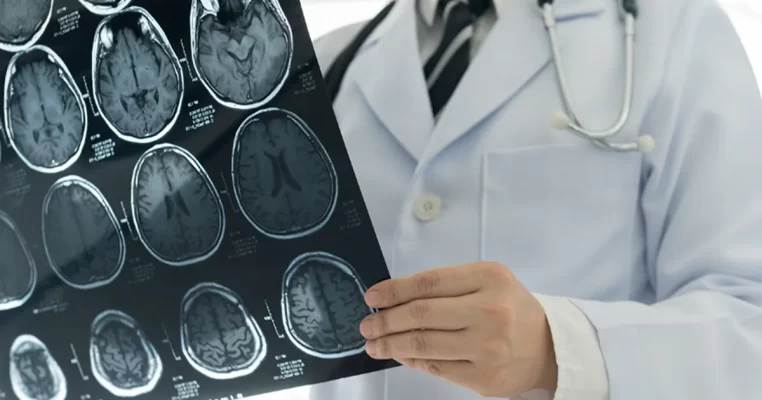 CT Scan là gì? Tìm hiểu nhanh về công nghệ y khoa tiên tiến