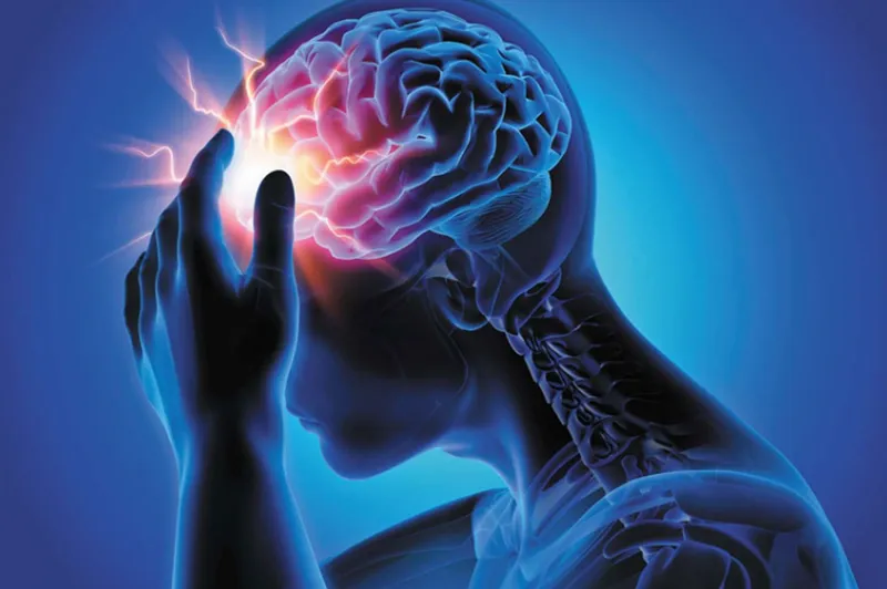 CT Scan sọ não được chỉ khi đau đầu kéo dài hoặc không rõ nguyên nhân (Ảnh: Sưu tầm Internet)