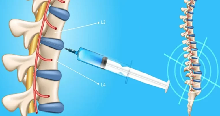 Xét nghiệm dịch não tủy: Quy trình, ý nghĩa và các chỉ số quan trọng