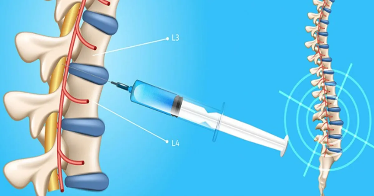 Xét nghiệm dịch não tủy: Quy trình, ý nghĩa và các chỉ số quan trọng