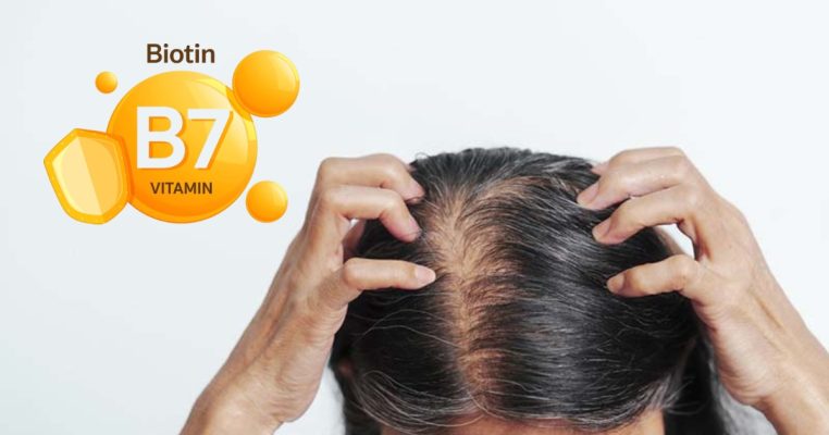 Biotin giảm rụng tóc cho phụ nữ trung niên: Liều dùng và cách bổ sung