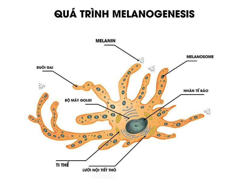 Quá trình melanogenesis bị rối loạn khiến tế bào sắc tố hoạt động quá mức, làm melanin tích tụ sâu trong da
