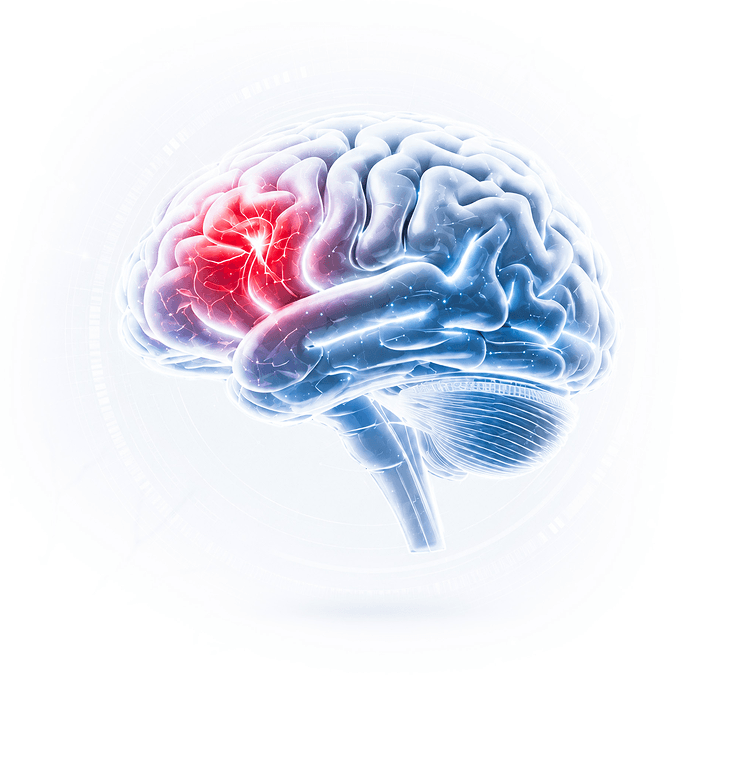 Brain Risk