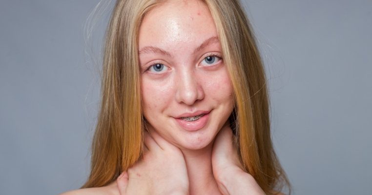 Looksmaxxing không rủi ro